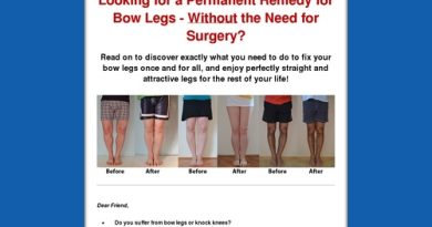 Bow Legs No More – How to Straighten Your Legs Without Surgery!